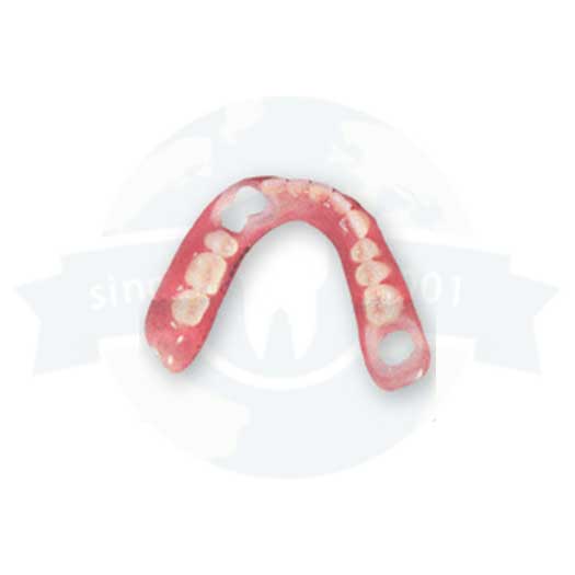 Cu-Sil® transitional denture with elastomeric gasket for comfort and tooth preservation