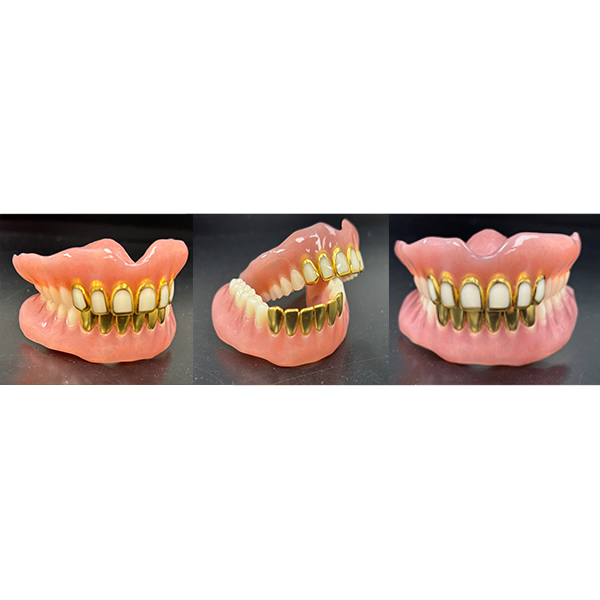 full mouth gold teeth dentures