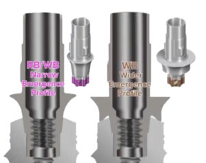 An Illustration showing RB & WB emergence dental implant types 
