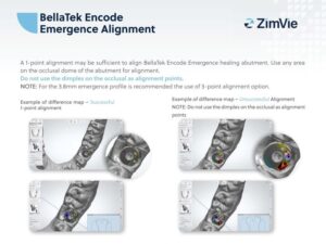 Steps of BellaTek Encode Emergence Alignment treatment by Global Dental Solutions in Atlanta, GA
