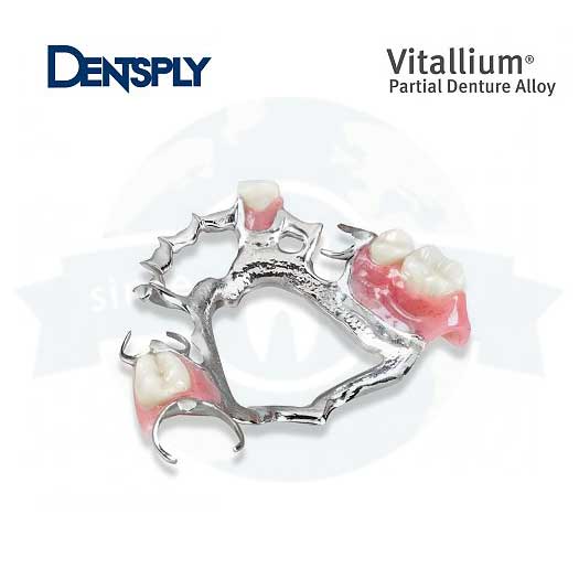 Vitallium partial denture alloy, Atlanta GA