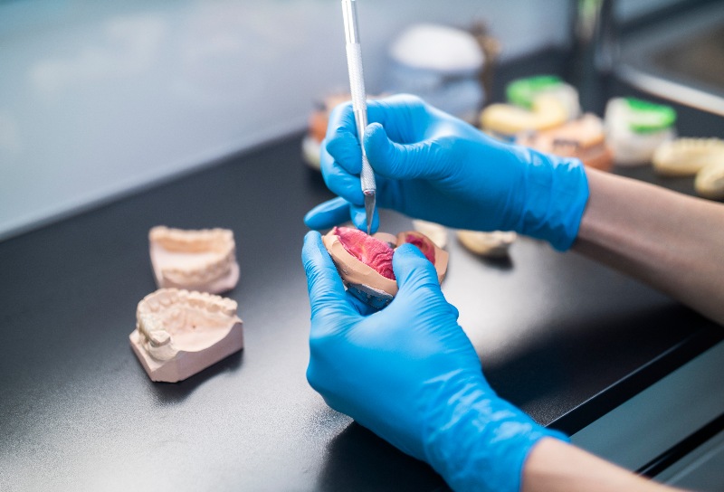 A Dental Technician Working on a Dental Plaster Model of a Patient's Teeth