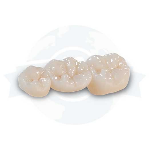 Full Contour Zirconia (Solid Zirconia)