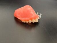 An obturator for the upper right quadrant and palate.