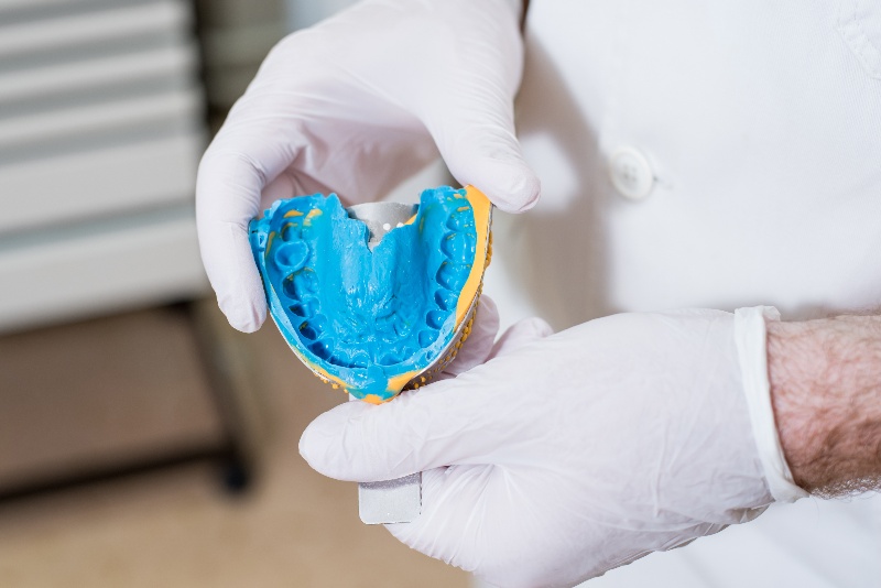 Dental Impression of a Patient Showing a Negative Mold of Teeth and Surrounding Oral Tissues