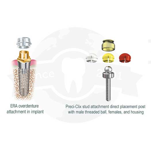 Stud & Bar Attachments