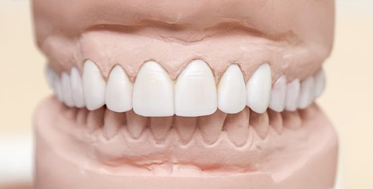 The tooth model features bright white teeth in Atlanta, GA.