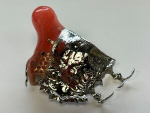 An Obturator for the upper posterior right quadrants for the teeth 