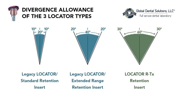 Divergence Allowance of the 3 Locator Types