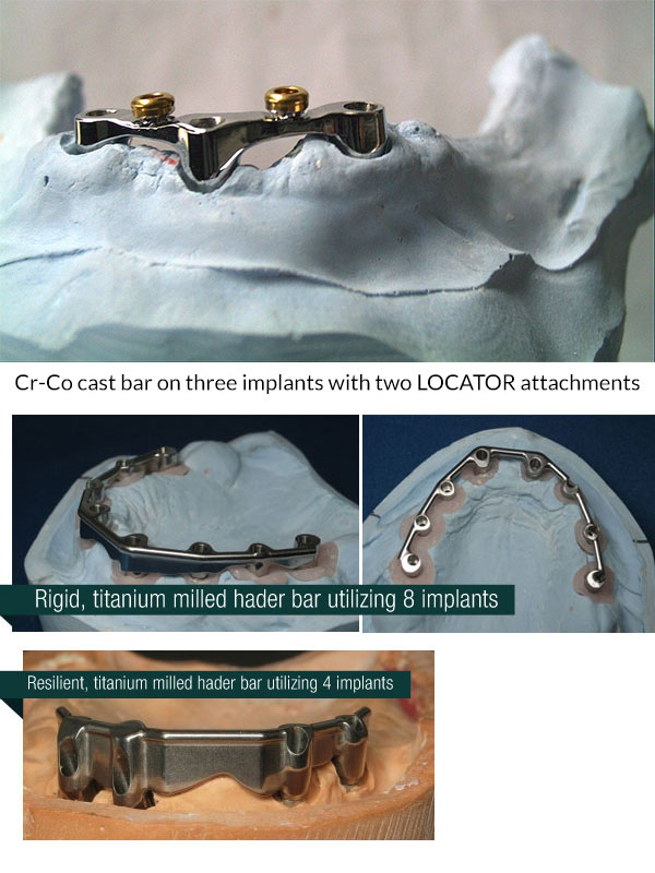 Cro-Co Cast Bar with LOCOTOR Attachments
